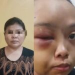 Sadis! Anak Yatim di Tarai Bangun di Aniaya Tante